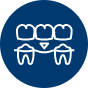 dental-bridge