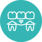 Invisalign