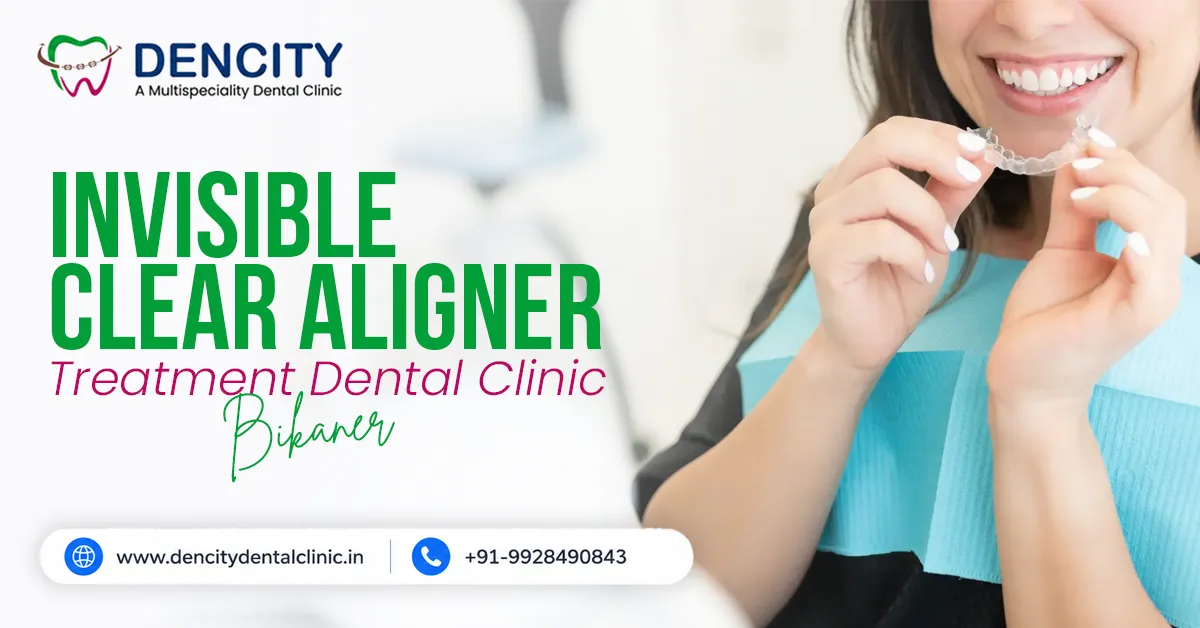Clear Aligner Dental Clinic Bikaner - Invisible Braces For Teeth Gap