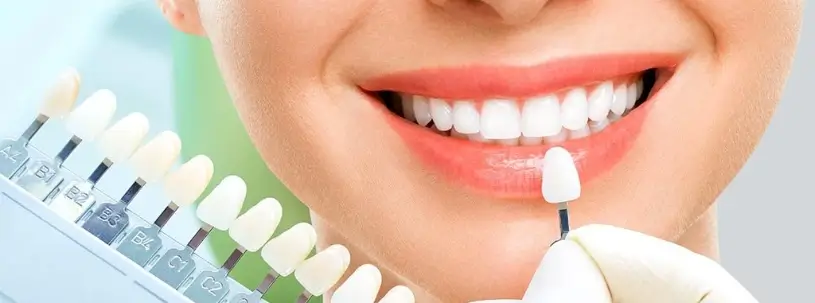 Dental Crown Or Veneer