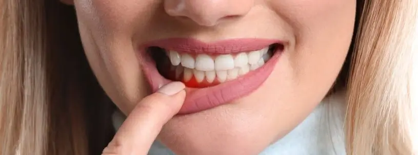Periodontal & Periodontics Surgeon